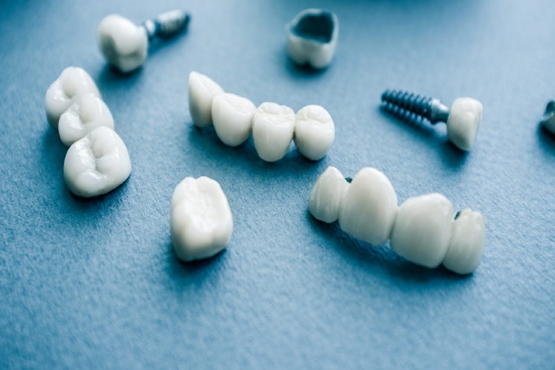 ceramiczne implanty dentystyczne